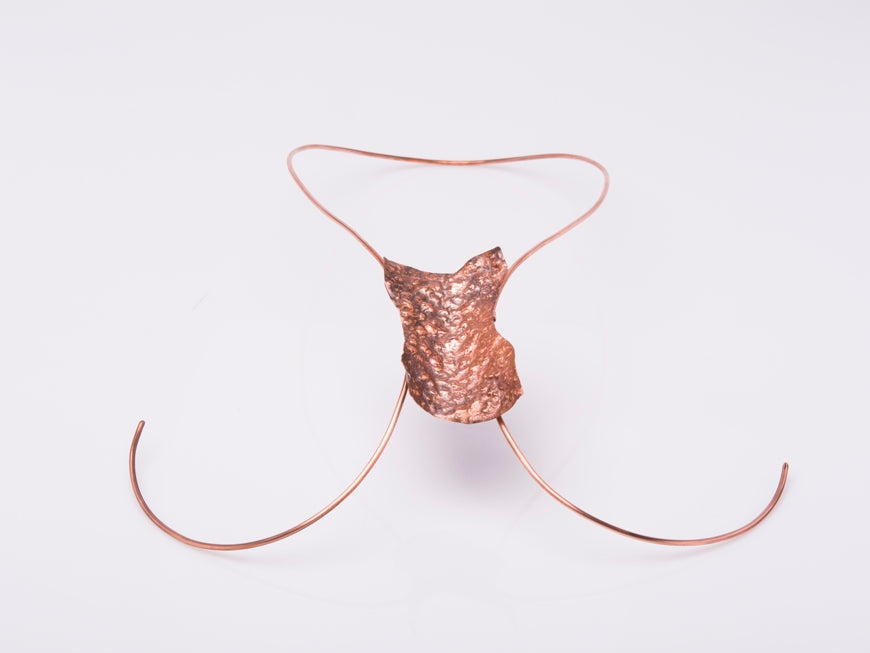 Jewellery- Rashes