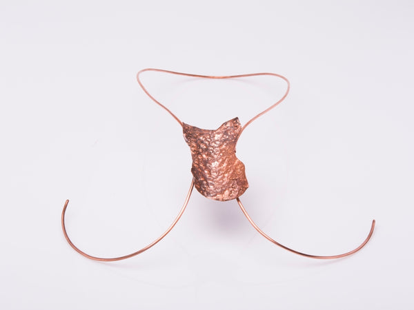 Jewellery- Rashes