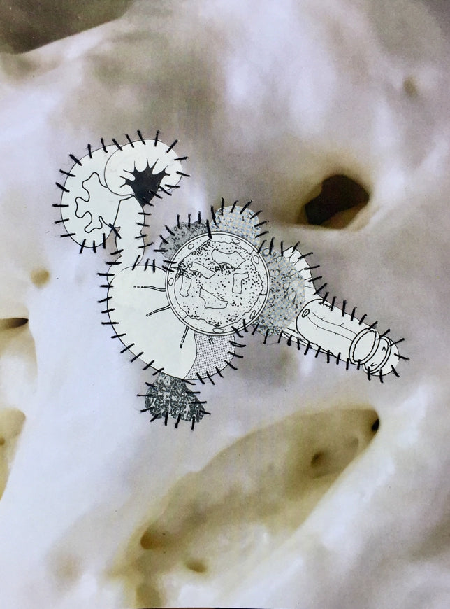 Parasite I (You’re)